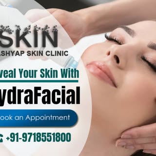 Reveal your skin with HydraFacial Treatment. Its a medical-grade resurfacing treatment that helps to