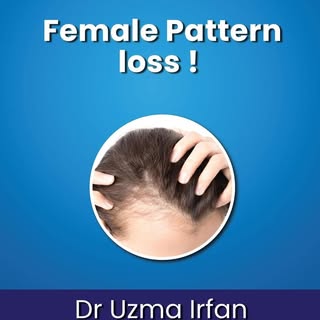 Female Hair Pattern loss !
For Consultation: +92 333 5010044
.
.
.
.
.
.
.
.
.
#druzmairfan  #HairFa