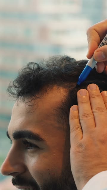 تخلص من الصلع الوراثي من البداية 
واستمتع بخط شعر كثيف وستايلات مالها حدود