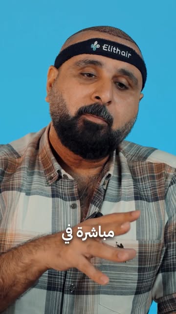 سنين طويلة من الصلع من الدرجة السابعة… خلت تجربة المعلق خليل البلوشي مع زراعة الشعر مختلفة من البداي