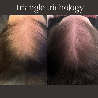 Hair growth is never guaranteed, but with the right plan, consistency, and a willingness to explore 