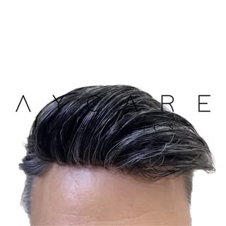 Wieder volles Haar!
Aber wie?

#aycare #hairspecialist #haarspezialist #haarausfall #haare #haarschn