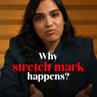 Your body tells a story, and stretch marks are part of it
Normal? Yes.
Untreatable? No.
There are sa