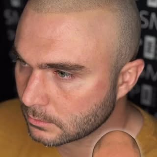 Scalp Micropigmentation is a life changing decision - do your research on your artist, meet with you