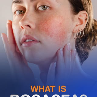 Redness, flushing, or sensitive skin that doesn’t go away? 👀

It could be rosacea, a common skin co