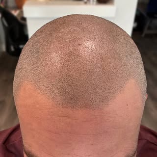 “The results speak for themselves.”

One of my recent clients shared this after his SMP sessions, an