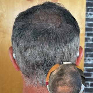 Added density. Big difference.

This client wanted to reduce the appearance of thinning while keepin
