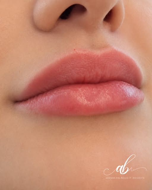 Aquele preenchimento labial que a gente ama: natural, delicado e respeitando a beleza do rosto.

Mai