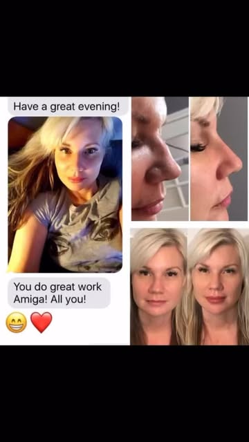 We LOVE getting texts like these from our patients. 😍

This is exactly what facial balancing is abo