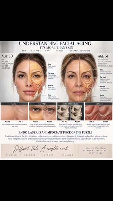 Endolaser regenerates the skin, stimulates collagen, tightens loose tissue, redefines contours, and 