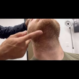 One of the biggest questions we get about using beard hair as a donor source is: What will the beard