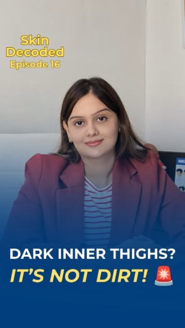 Dark inner thighs? It’s NOT poor hygiene! 🚨

Friction, hormones, pigmentation, weight changes & ins