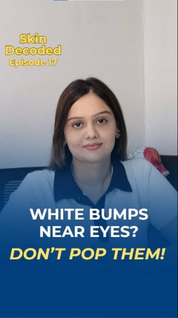 Those tiny white bumps near your eyes? 👀
They’re probably NOT pimples!

Comment “SkinPuritys” to kn