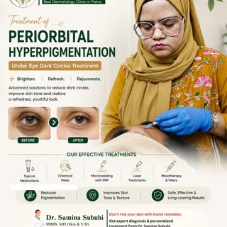 👀 Tired of dark circles that make you look tired even after a good night's sleep? 👀

Periorbital h