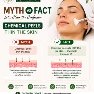 🌿 Chemical Peels Don’t Simply “Thin the Skin” — Let’s Clear the Myth!

Chemical peels are designed 
