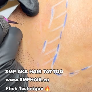 What is Scalp Micropigmentation (SMP)?

SMP is a life-changing, non-surgical solution for hair loss!