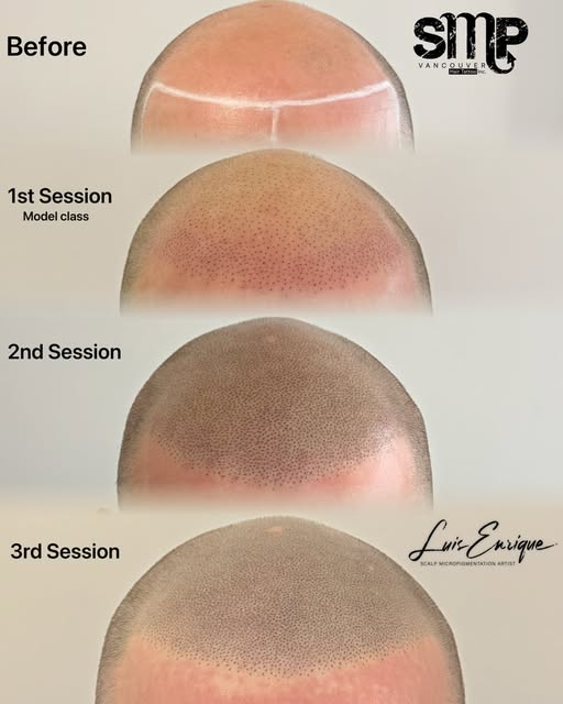 A natural result is built one session at a time.

This client completed a total of three SMP session
