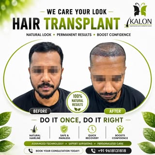 ✨ Regain Confidence, Redefine Yourself ✨
At KALON Hair Transplant & Cosmetic Clinics, we believe you