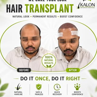 ✨ Regain Confidence, Redefine Yourself ✨
At KALON Hair Transplant & Cosmetic Clinics, we believe you