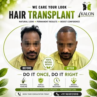 ✨ Regain Confidence, Redefine Yourself ✨
At KALON Hair Transplant & Cosmetic Clinics, we believe you