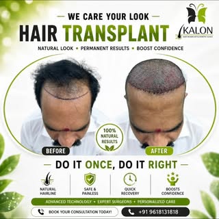 ✨ Regain Confidence, Redefine Yourself ✨
At KALON Hair Transplant & Cosmetic Clinics, we believe you