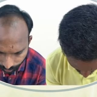 ✨ Regain Confidence, Redefine Yourself ✨
At KALON Hair Transplant & Cosmetic Clinics, we believe you