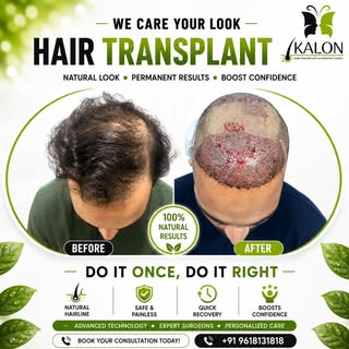 ✨ Regain Confidence, Redefine Yourself ✨
At KALON Hair Transplant & Cosmetic Clinics, we believe you