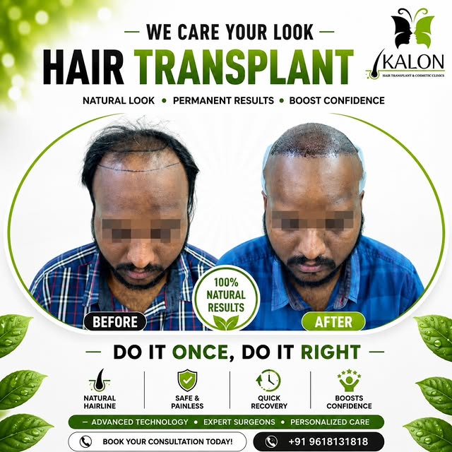 ✨ Regain Confidence, Redefine Yourself ✨
At KALON Hair Transplant & Cosmetic Clinics, we believe you