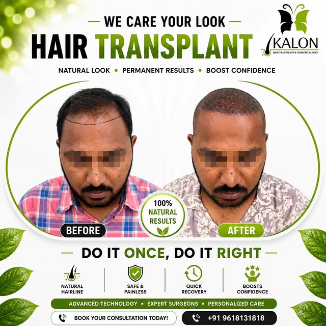 ✨ Regain Confidence, Redefine Yourself ✨
At KALON Hair Transplant & Cosmetic Clinics, we believe you