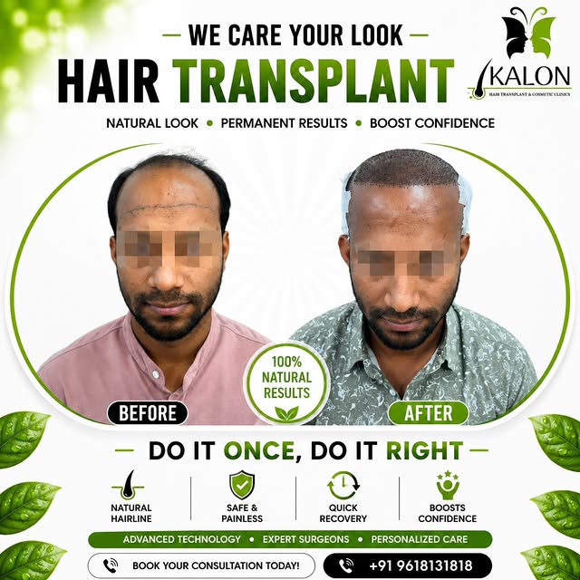 ✨ Regain Confidence, Redefine Yourself ✨
At KALON Hair Transplant & Cosmetic Clinics, we believe you