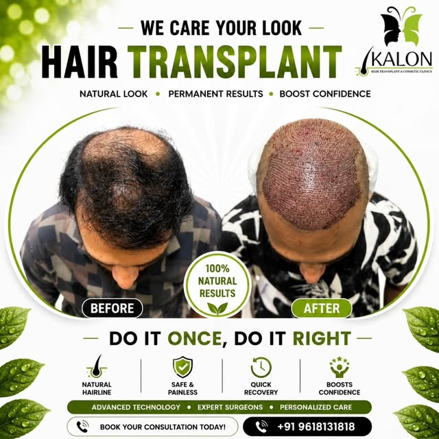 ✨ Regain Confidence, Redefine Yourself ✨
At KALON Hair Transplant & Cosmetic Clinics, we believe you