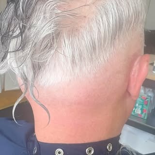 Not every client is a candidate for the same hair replacement solution—and that’s exactly why custom
