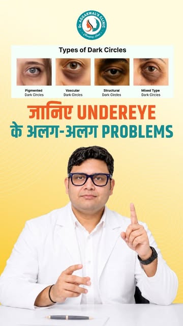 Face Fresh Hai… Phir Bhi Eyes Itni Tired Kyun Lagti Hain? 👀

Dark Circles, Under-Eye Bags, Fine Lin