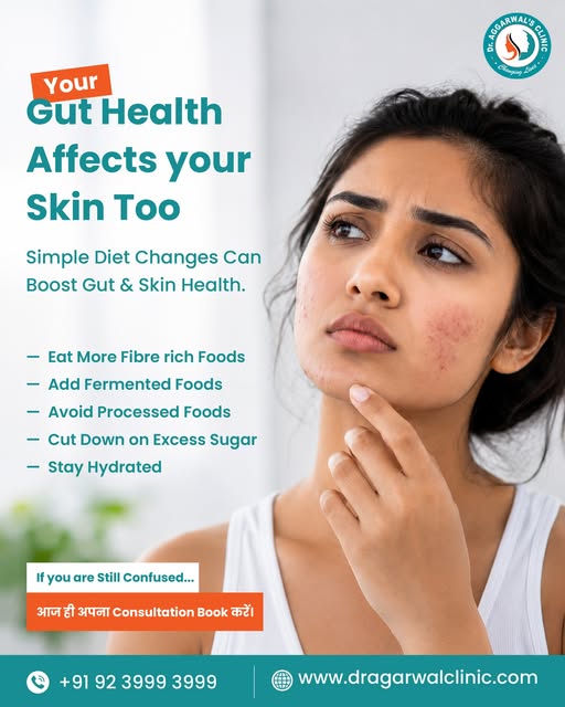 Your Gut Health Can Affect Your Skin Too. 👀✨

Acne, breakouts, dullness or skin inflammation ko sir