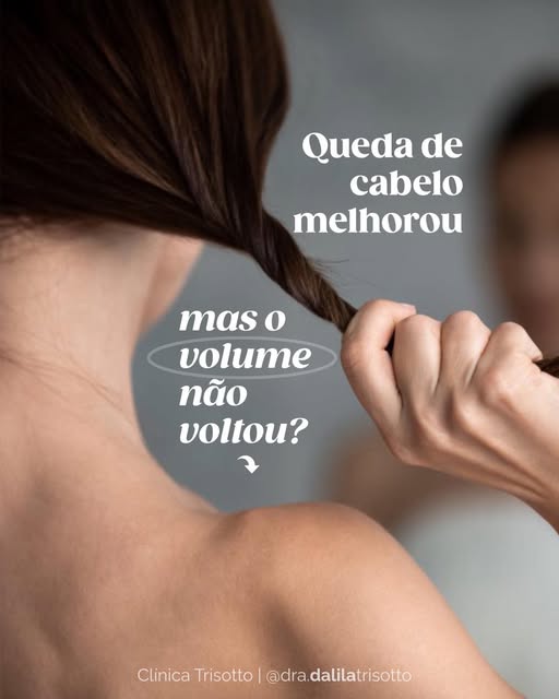 Essa é uma das queixas dos pacientes que passaram por um Eflúvio telógeno após uso de canetas emagre