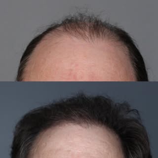 Another one of our amazing client transformations! Fun fact about us: we take our pre- and post-op c