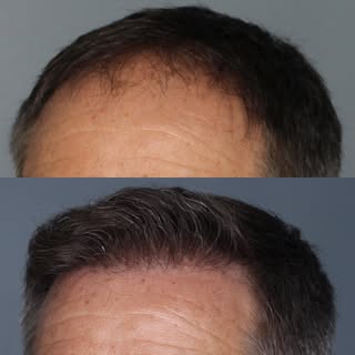 Another before and after to get you through the rest of the week! 

We have been very busy here at A