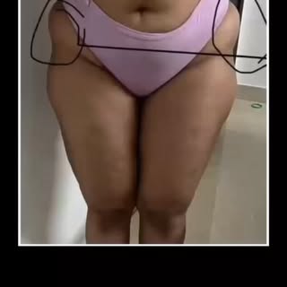 Hip Dip Fat Grafting 

Dr. Sumeet jaiswal
MBBS, MS, MCH, (Plastic surgeon)

Zenith cosmetic & hair t