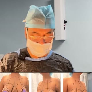 Breast Reduction Surgery 

Dr. Sumeet jaiswal
MBBS, MS, MCH, (Plastic surgeon)

Zenith cosmetic & ha
