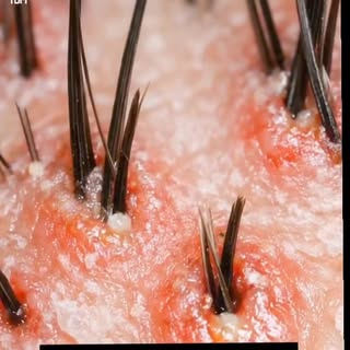 Queda de cabelo por tração

Penteados apertados, alongamentos e hábitos repetitivos podem enfraquece