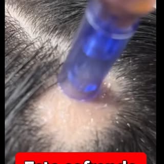 Está sofrendo com falhas no couro cabeludo ou queda de cabelo?

Faça uma avaliação e inicie seu trat