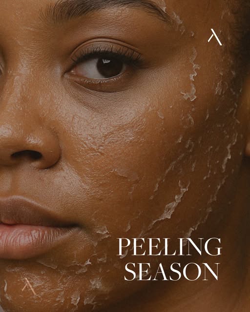 Peeling season is back! 🍂

Het najaar is het moment om je huid weer intensief te vernieuwen. De zon
