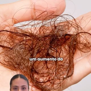 Tem muitas informações sobre o Minoxidil que quase ninguém te conta sobre ele.

Existem alertas impo