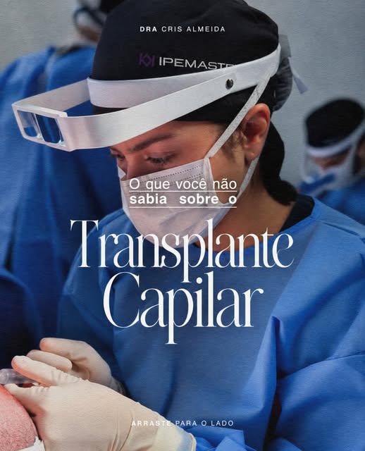 Existem alguns detalhes sobre o transplante capilar que muita gente só descobre depois de realizar o