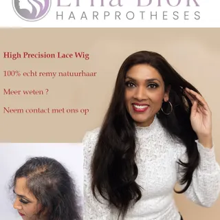 High precision lace wig , modern onzichtbaar haarwerk verkrijgbaar bij Erna Blok Haarprotheses

#lac