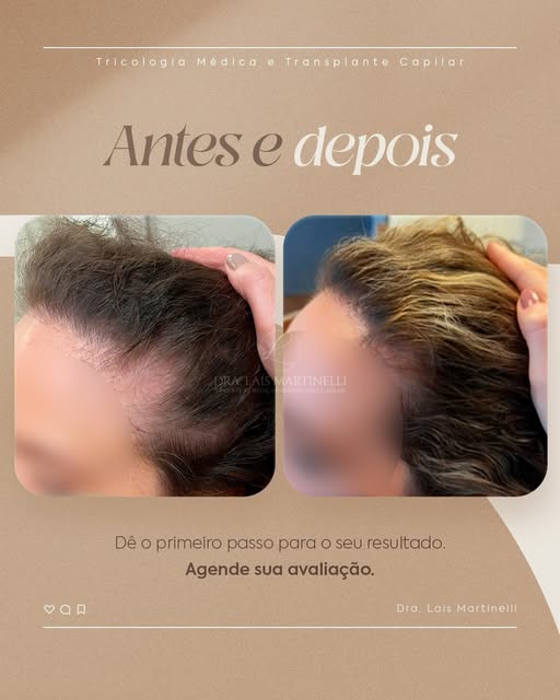 Resultados que devolvem confiança também começam com um diagnóstico bem feito.

Cada caso tem uma ca