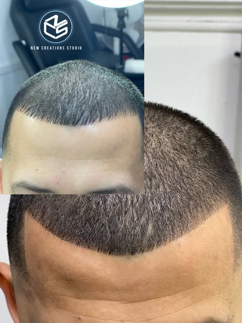 🔥 EDGE UP RESTORATION SPECIAL 🔥

Ready for a cleaner, fuller-looking hairline?

💈 SAVE UP TO $1,2