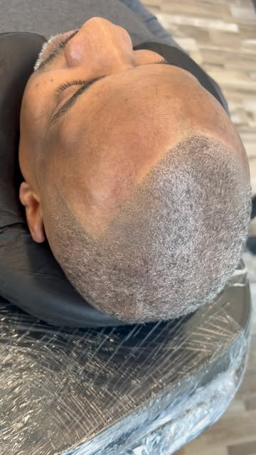 THIS IS WHAT SMP CAN DO. 🔥

From a thinning, uneven look to a cleaner, fuller, more defined appeara