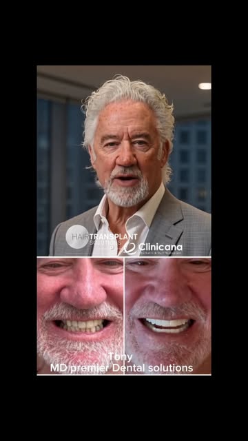 🦷 WHY I DECIDED TO MOVE INTO DENTAL

For many years, I’ve built Hair Transplant Solutions around on