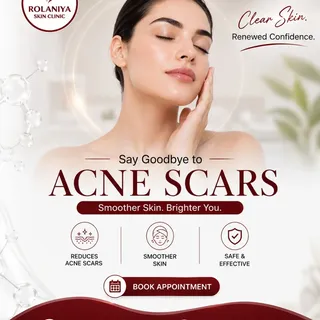 Acne scars don't have to be permanent. ✨

Restore smoother, clearer, and healthier-looking skin with